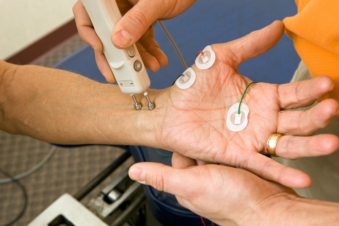Mi az elektromos stimuláció (elektroterápia)?