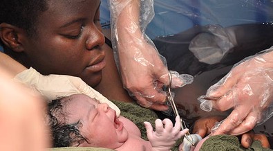 5 facts about caesarean section you probably didn’t know