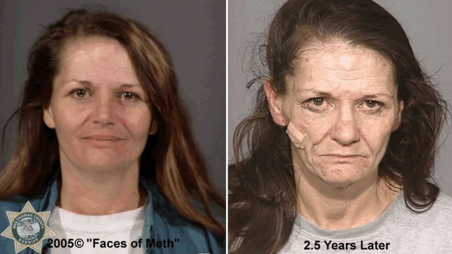 Destrukcyjne działnie amfetaminy - wygląd przed jej zażywaniem i 2,5 roku później. Fot. powstała w ramach projektu przeciwdziałania narkomanii w USA "Faces of Meth"