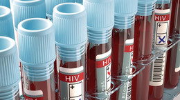 Zbrojenie komórek przeciw HIV