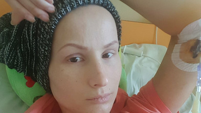 Újra teljes értékű életet élhet: visszanőtt a rákbetegség után a modell haja