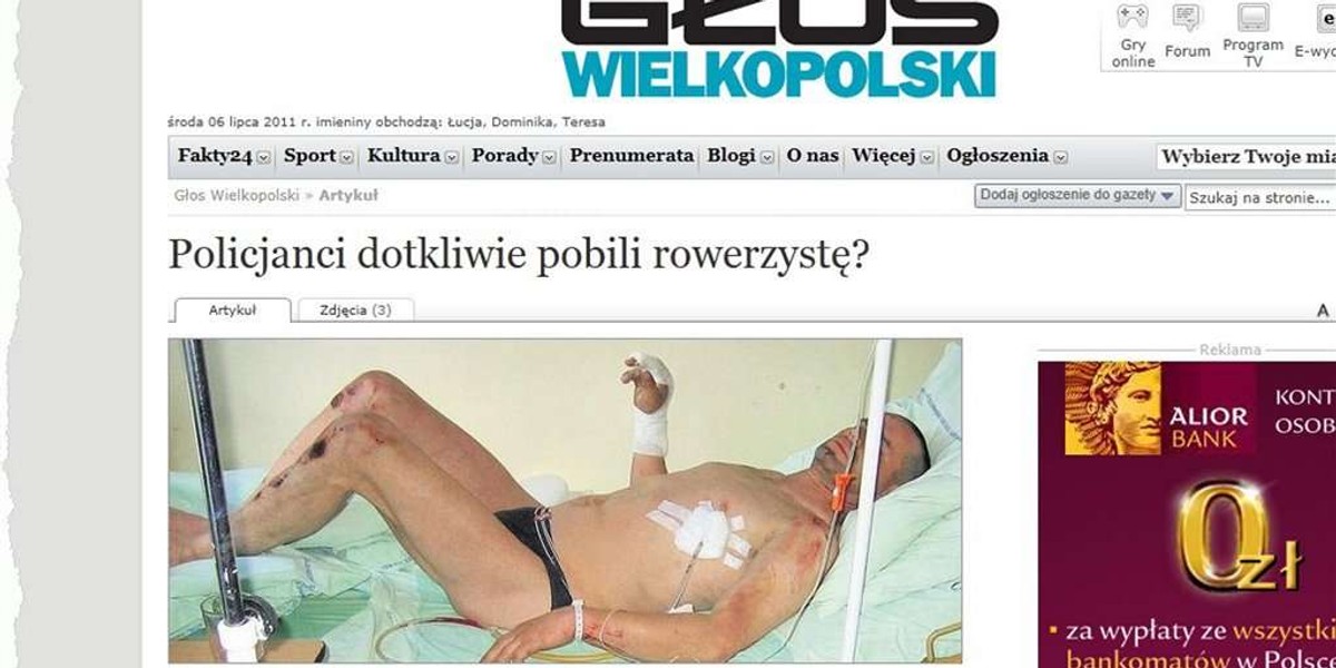 Żenująca akcja policji. Skatowali rowerzystę za...?