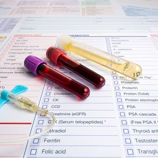 Mit mutat meg a vérkép? Ezekről árulkodnak a biomarkerek