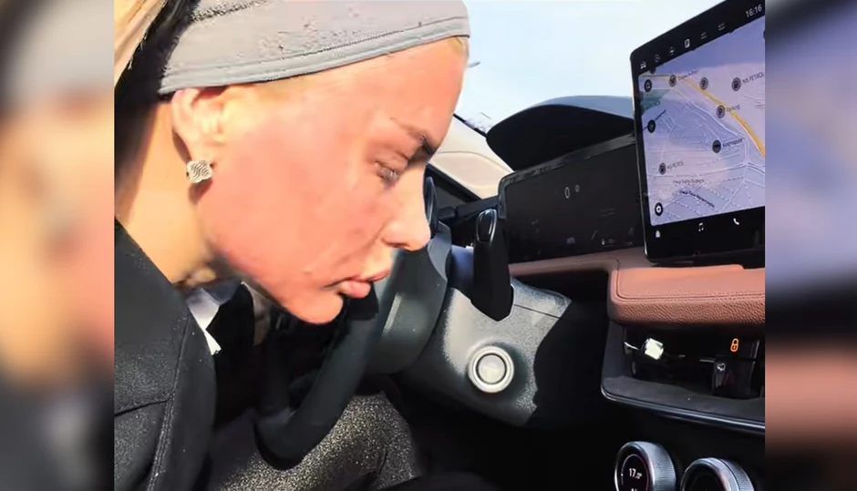 Milici Kemez celo lice crveno i u ožiljcima: Bivša zadrugarka šokirala, hladi glavu klimom u automobilu