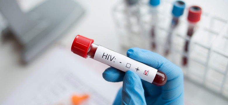 Przełom w HIV? Naukowcy twierdzą, że potrafią usunąć wirusa z komórek