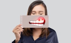 Dziedziczna? Nieuleczalna? Najpopularniejsze mity o paradontozie