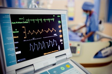 terheléses nyugalmi EKG vizsgálat  szívritmus, vérnyomás, pulzusszám