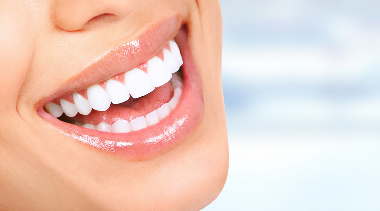 Az öröklött fogászati problémák is orvosolhatók. /Fotó: Shutterstock