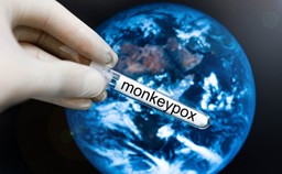 Małpia ospa? Wirusolog: Pandemii z tego nie będzie