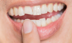 Ruszają ci się zęby? To może być objaw raka