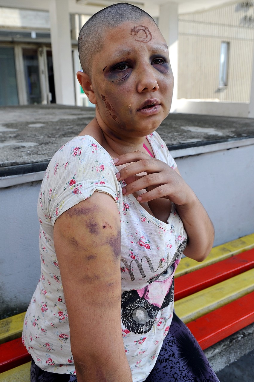 Ahmet se dva dana iživljavao nad Marija Ferizović (21)