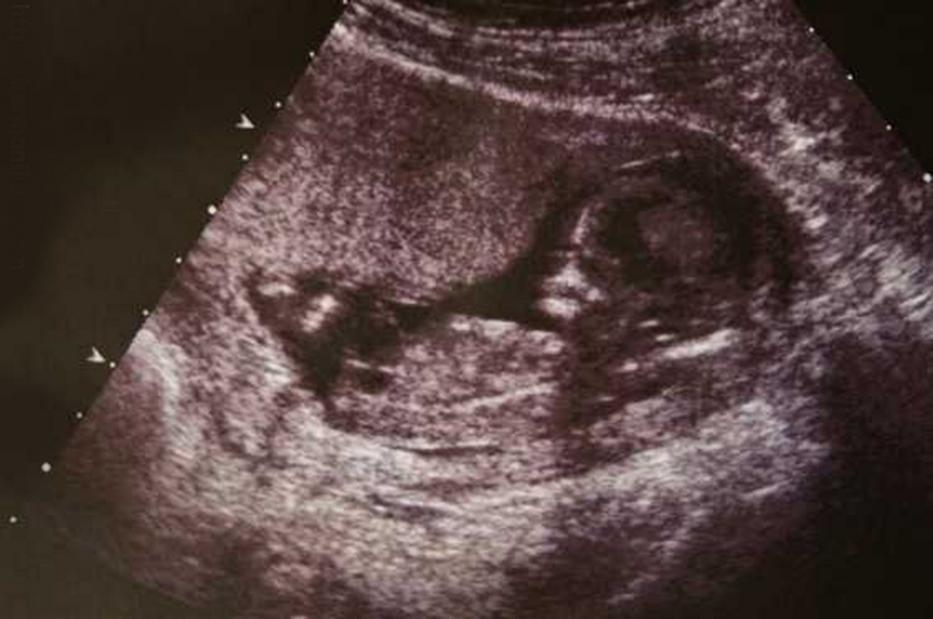 Amikor a baba megszületik, az orvosok nem hisznek a szemüknek, a szülők pedig legrosszabb rémálmukat élik át