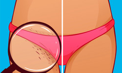 Dermatolożka mówi, jak golić miejsca intymne i przestrzega przed kardynalnymi błędami
