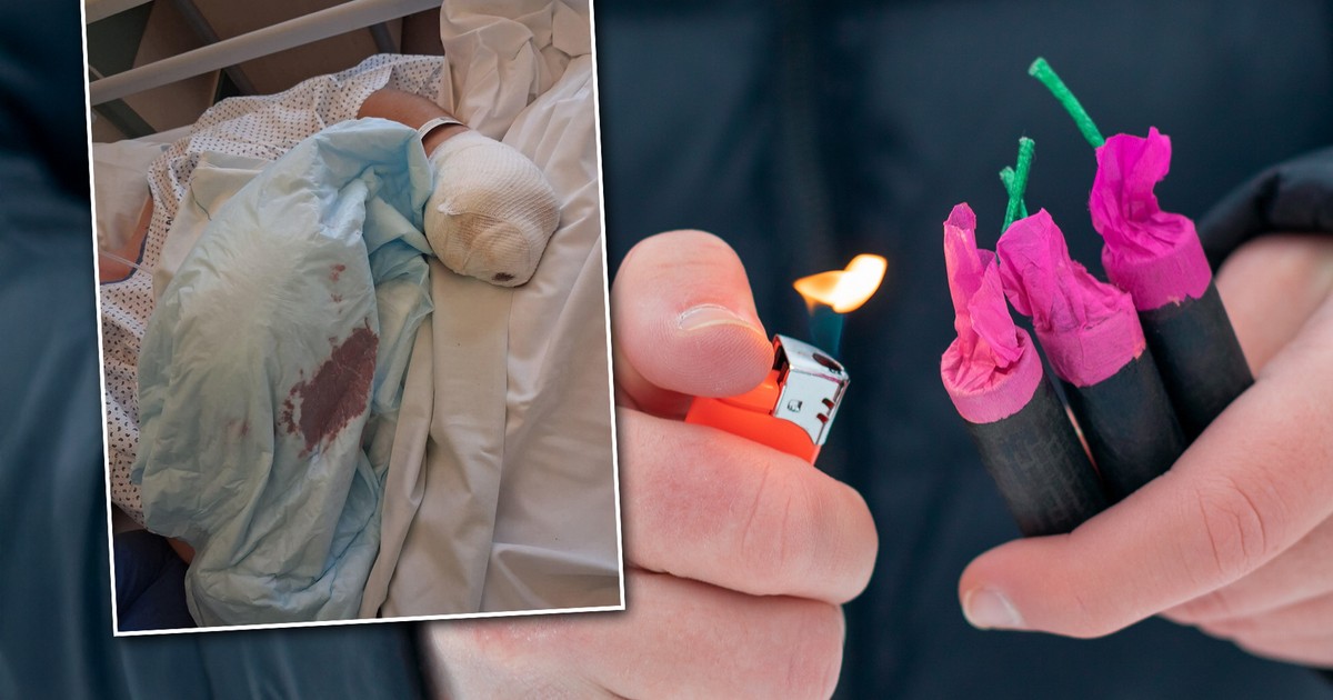 Dramat w sylwestra w Jastrowiu. Na miejscu policja. Rodzice proszą o jedno. "Dłonie nie odrosną"