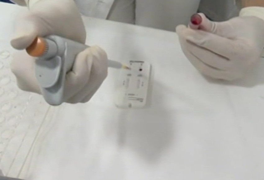 Ceo proces traje samo nekoliko sati