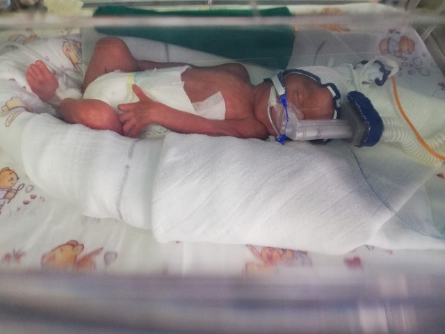 Bebe su u inkubatoru Instituta za neonatologiju i dobro napreduju, kažu roditelji i lekari