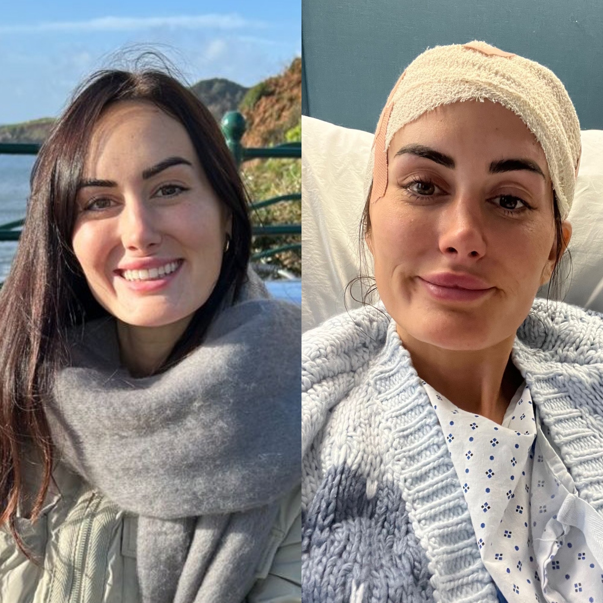 Lauren odhalili vážne ochorenie.