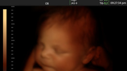 Jövőre már nem kérhetnek a szülők 3D-s ultrahangfelvételt: ezért tiltják be a babamozit