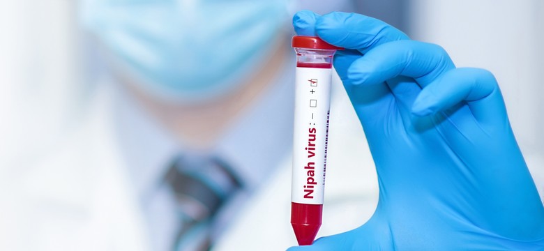 Kolejne zakażenia wirusem Nipah. To jeden z najbardziej śmiertelnych wirusów świata. Ma "potencjał pandemiczny"