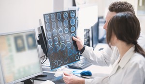 Rredak, ali težak oblik dečje epilepsije uzrokovan je pojedinačnom mutacijom na SCN2A genu