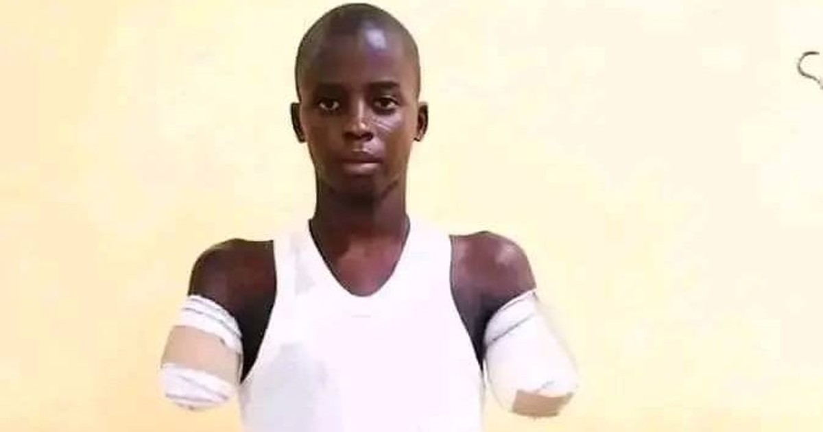 12-year-old's arms cut off by uncle over alleged phone theft; NBA demands justice - Vimarsana News