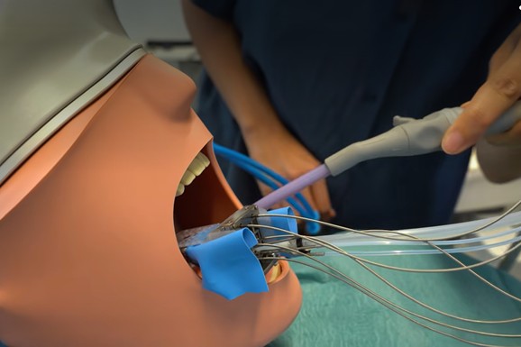 Roboti će zameniti i zubare! Naučnici predstavili mini verziju, priprema zube za KRUNICE, a PRECIZNOSTI mu je neverovatnih 0,2 milimetra