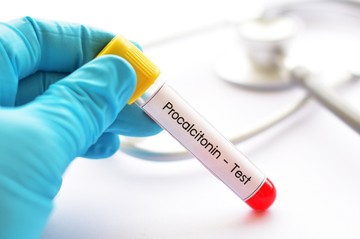 Mit jelent a prokalcitonin (PCT) érték a laborleleten?