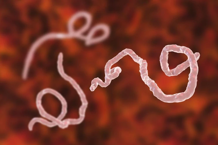 Choroby, które mogą zabić w ciągu doby. Gorączka krwotoczna Ebola