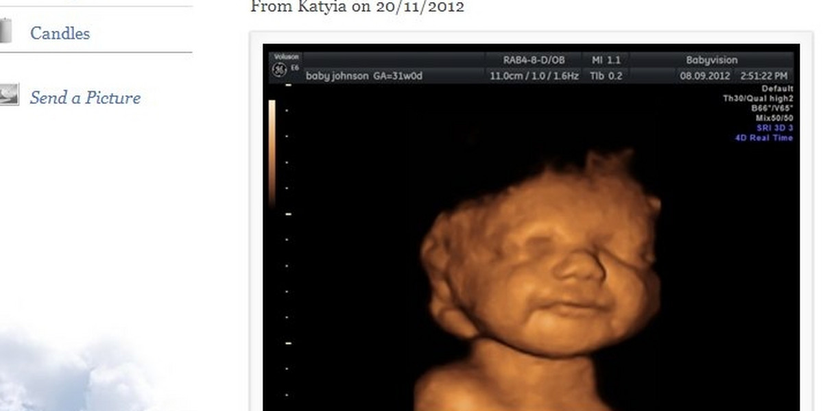 Zdjęcie USG ocaliło dziecko przed aborcją