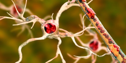 Átváltozhat egy jóindulatú tumor rosszindulatú daganattá?