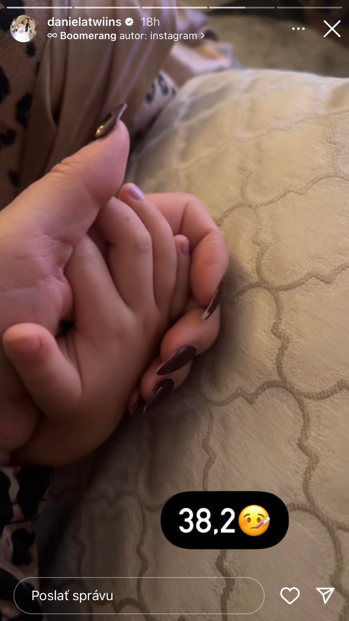 Dcérka Daniely Nízlovej si prechádza nepríjemnou chorobou.