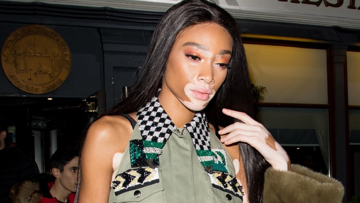 Winnie Harlow