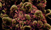  Jak wirusy "oszukują" układ odpornościowy? Naukowcy znaleźli odpowiedź 