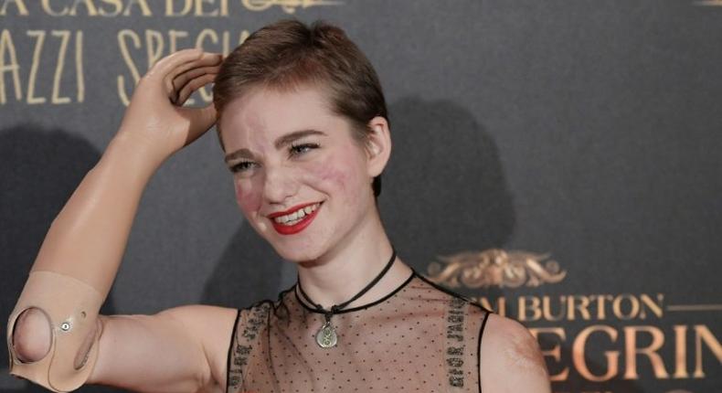 Fencing champion's Italian Beatrice Vio had been fencing since the age of five before a bout of meningitis cost her her two forearms and both legs