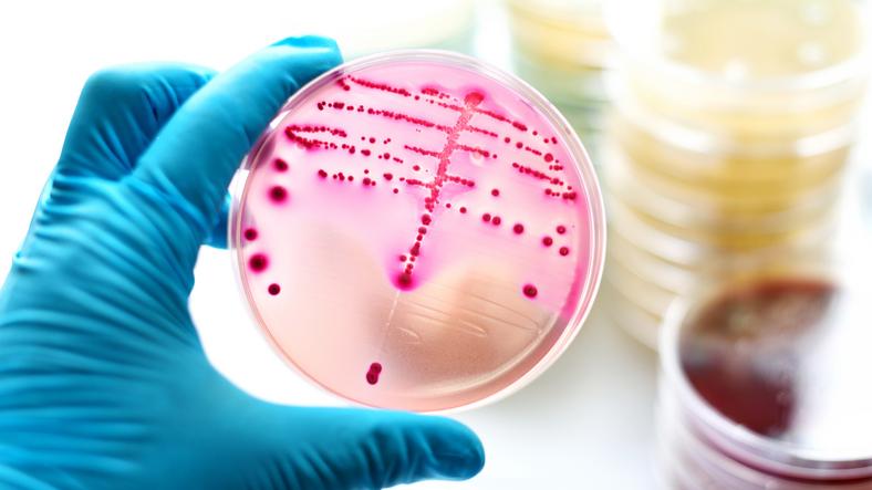 Gdy bakteria coli występuje w moczu. Ryzyko zarażenia, objawy, leczenie -  Zdrowie