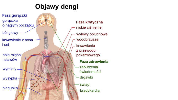 Objawy dengi