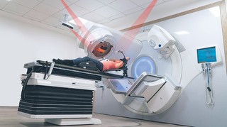 Nowa jakość precyzji – radioterapia sterowana obrazem