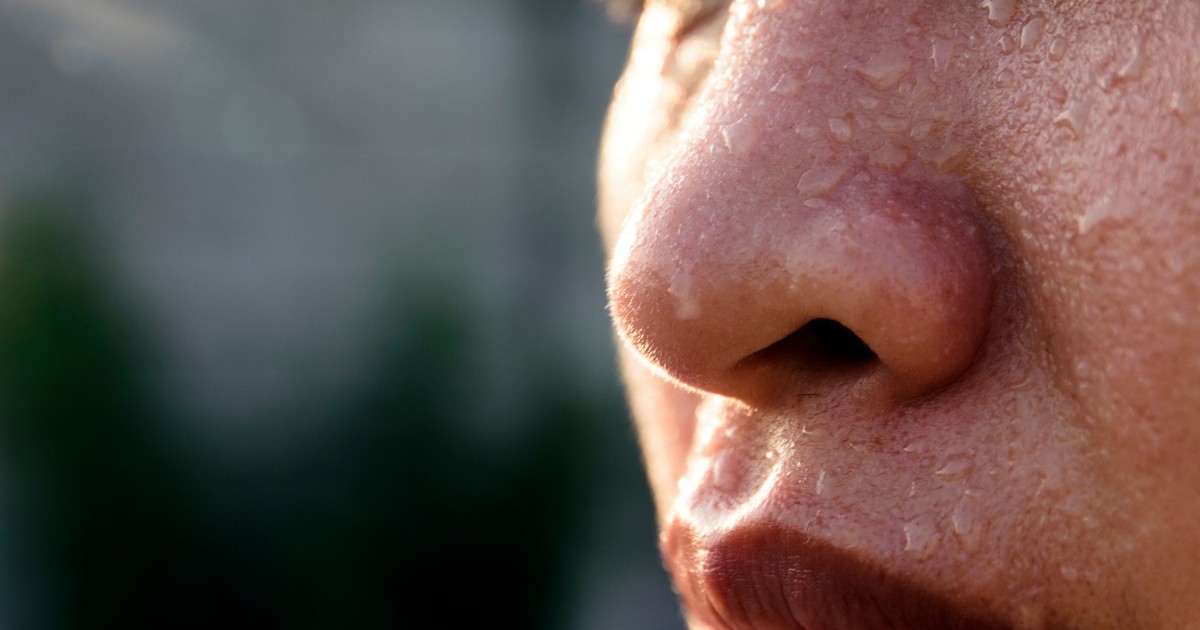 Dr. Pimple Popper Just Squeezed A Monster Milia On A Woman's Nose In