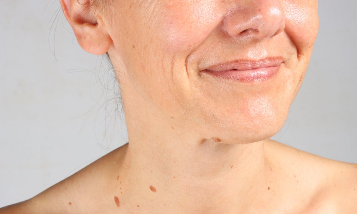 Trzy niezawodne kremy na zmarszczki marionetki. Napinają jak niewidoczne nici 