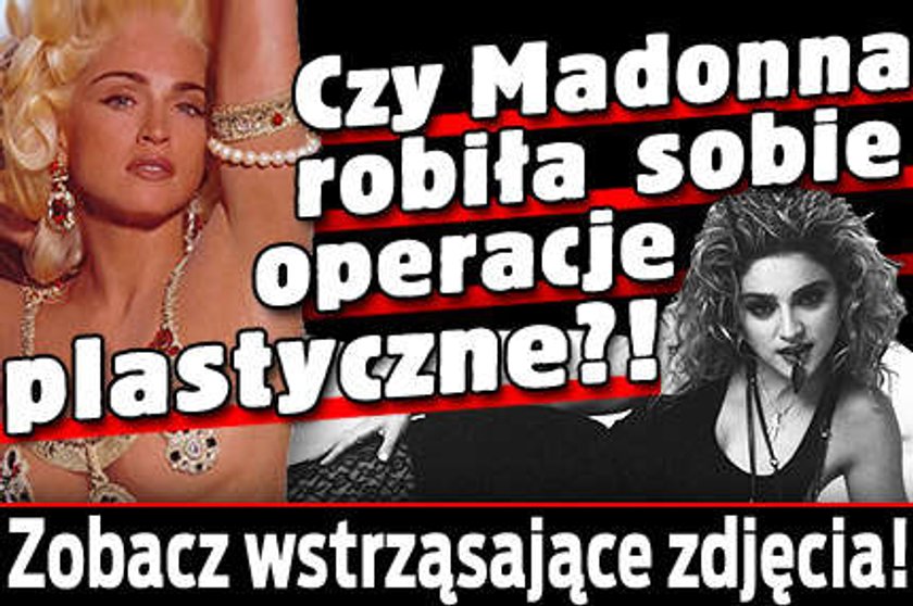 Czy Madonna miała operacje plastyczne?