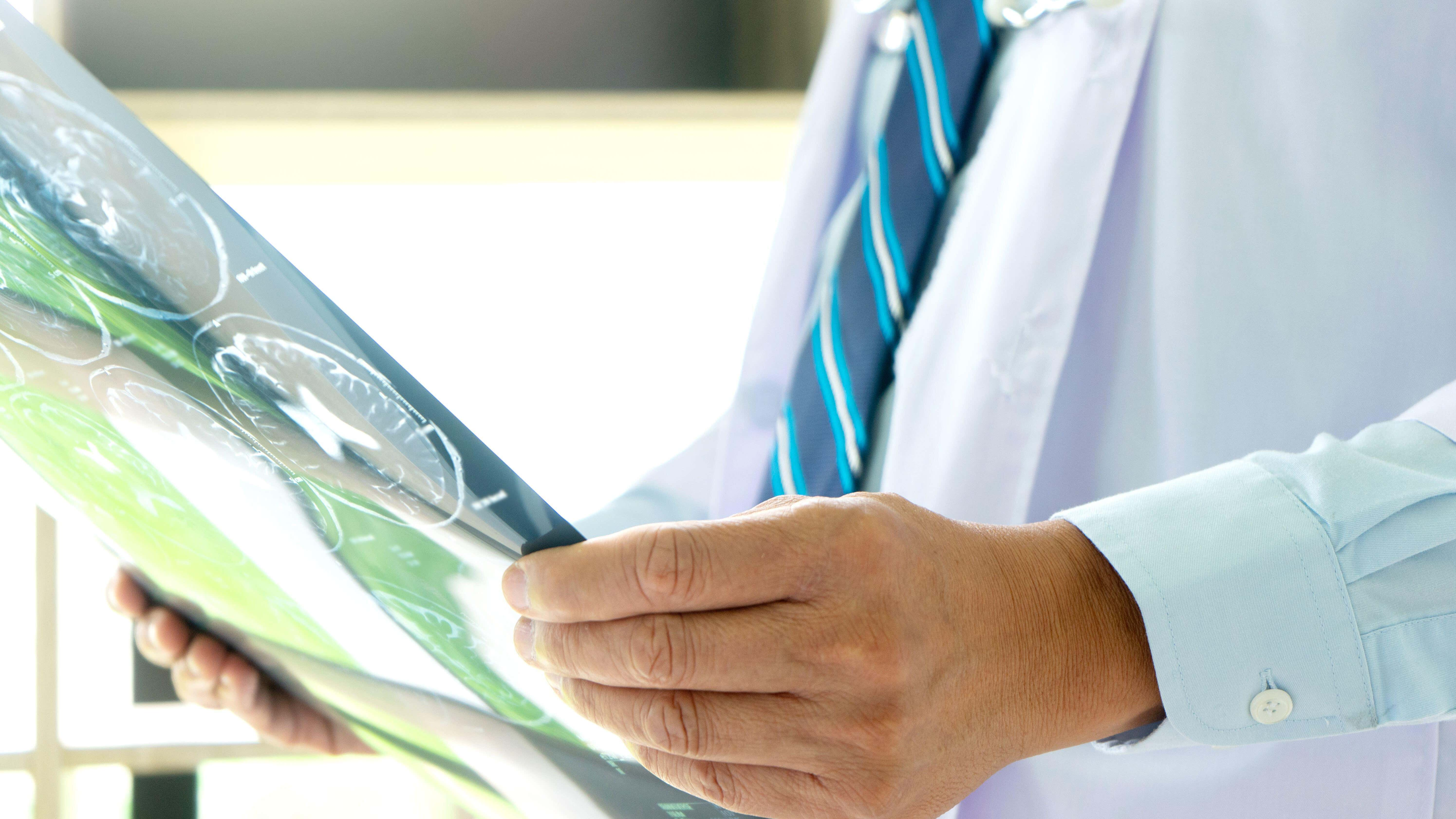 Mobile stroke units could slash emergency admissions by 86% in Scotland