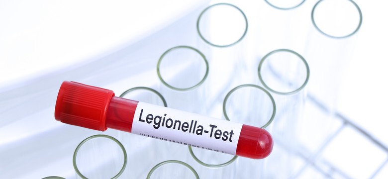 Legionella w Polsce. Nie żyje 14 osób