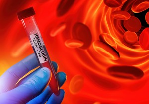 Hemoglobin je protein u crvenim krvnim zrncima koji prenosi kiseonik od pluća do ostatka tela