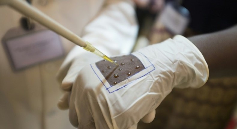 A volunteer at Burkina Faso's National Centre for Malaria Research and Training, puts Faso Soap on part of their hand to test its effectiveness