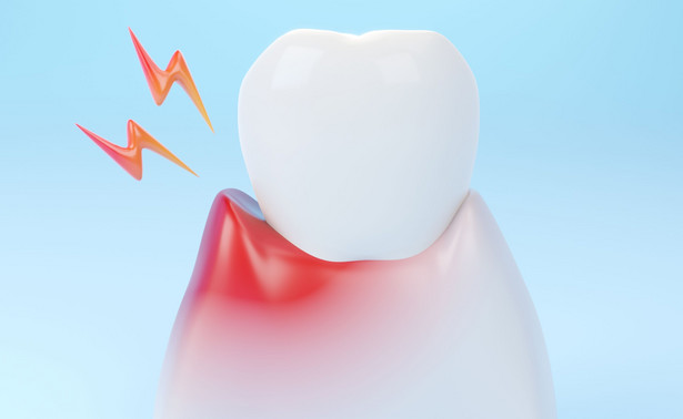 Dziąsła zdradzają, co nam dolega. Jak o nie dbać, by były zdrowe?