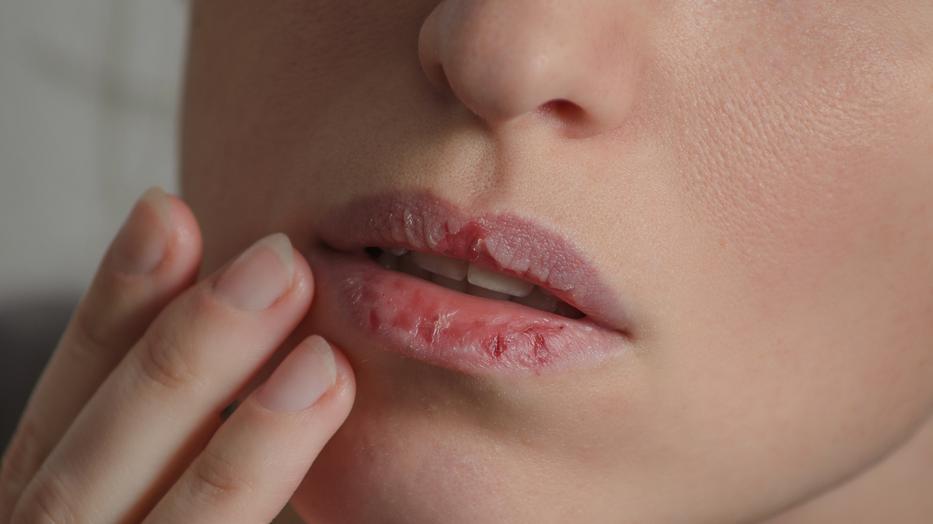 5 betegség, amitől büdös lesz a szája - Dívány