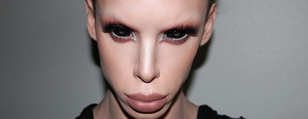 Több mint 100 műtét után nem nélküli űrlény lett a fiatal művészből 1