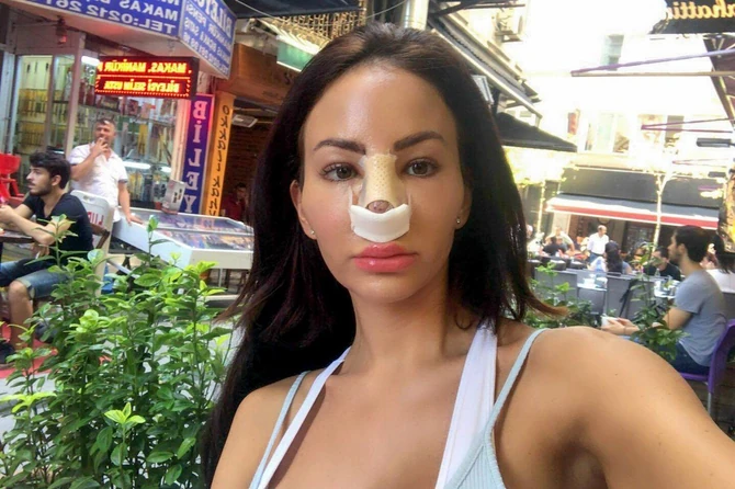 O operacijama redovno izveštava pratioce