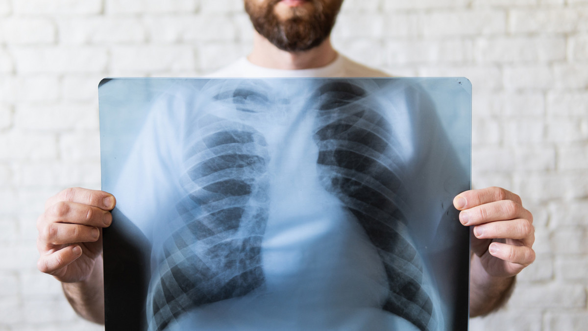 Detoks płuc – naturalne sposoby na oczyszczanie płuc, nie tylko dla palaczy