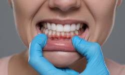 Jak objawiają się odsłonięte szyjki zębowe? Dentystka tłumaczy